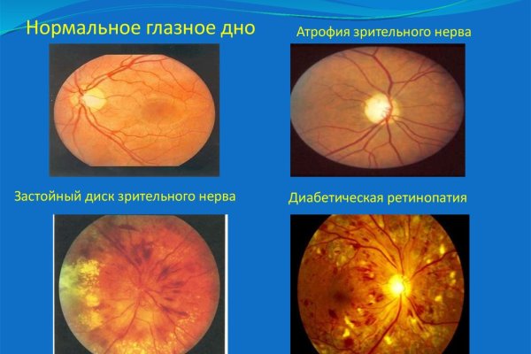 Кракен сайт зеркало рабочее